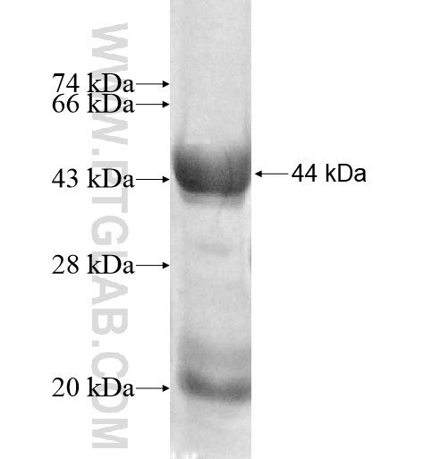 ECSA fusion protein Ag11004 SDS-PAGE ECSA fusion protein Ag11004 SDS-PAGE