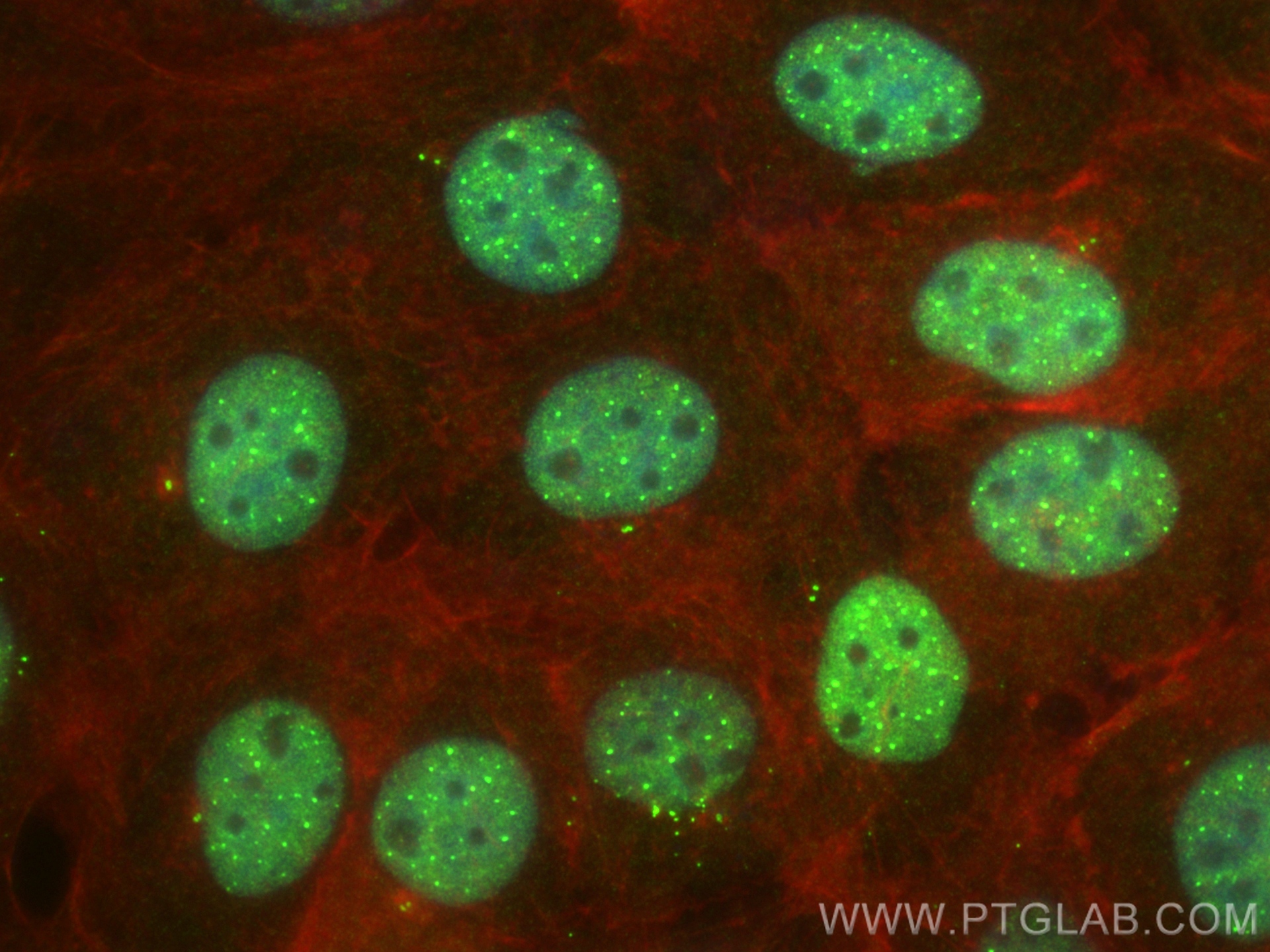 IF Staining of A431 using 83295-5-RR