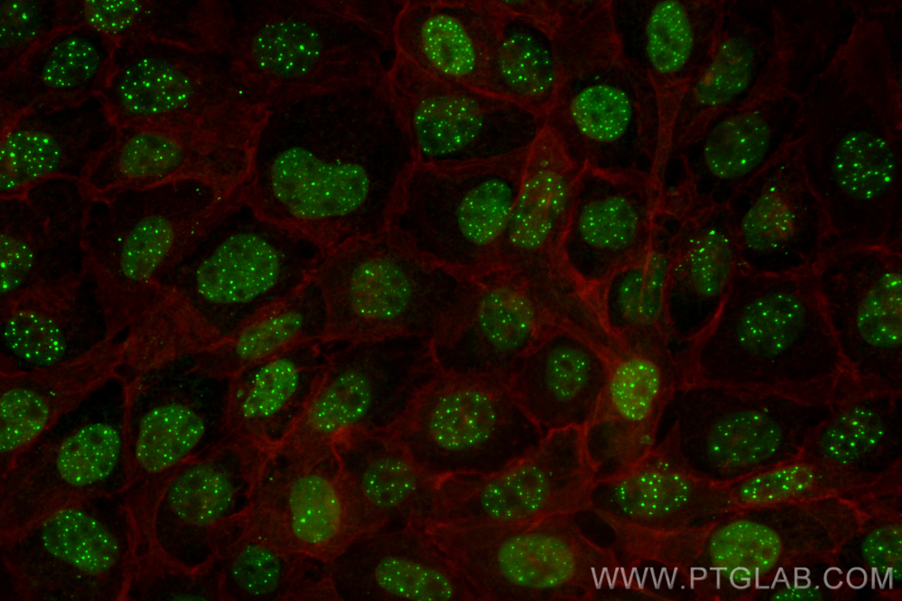 IF Staining of A431 using CL488-83295-5