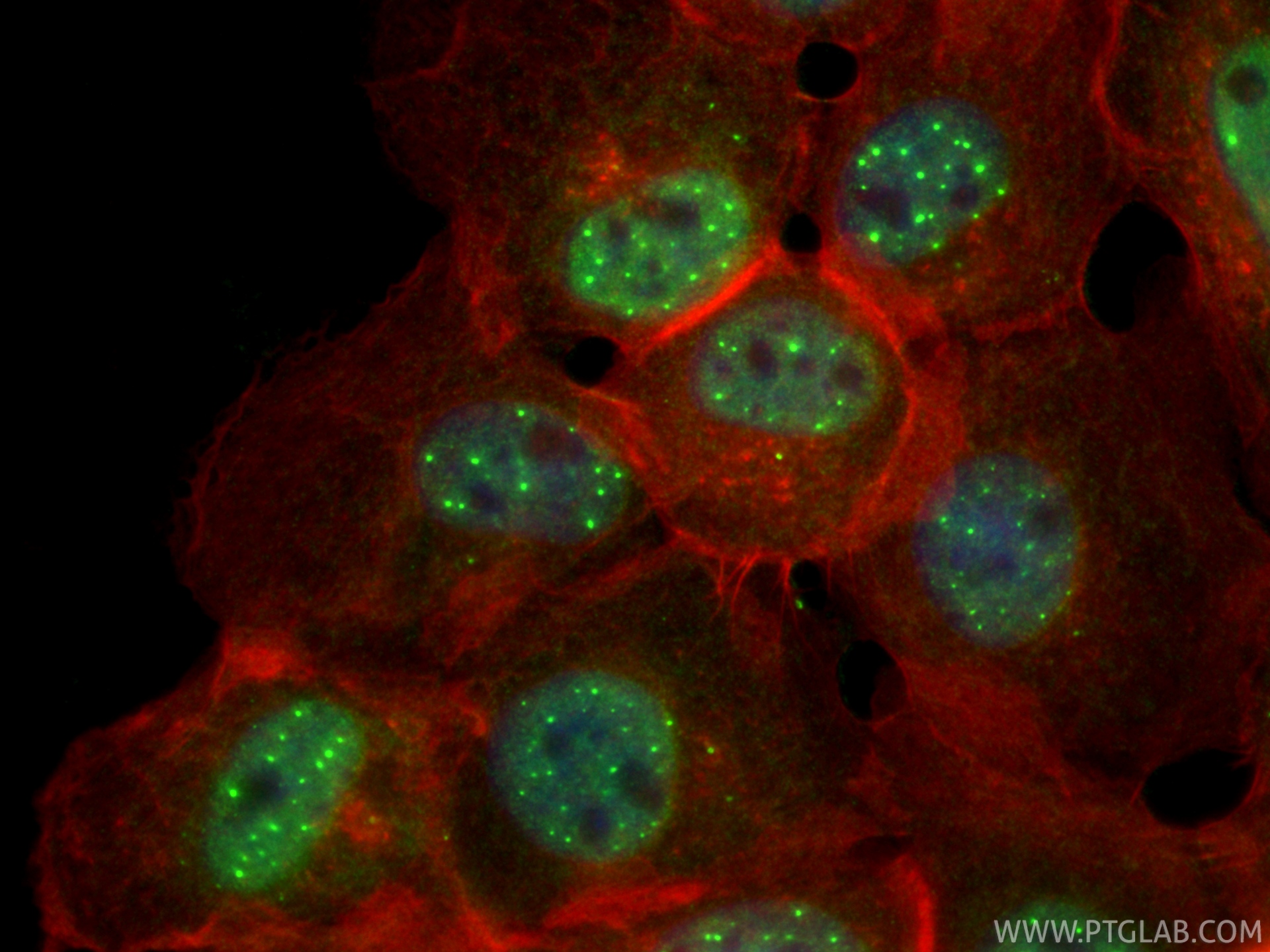 Immunofluorescent analysis of (4% PFA) fixed A431 cells using ECSIT antibody (RMX00048) at dilution of 1:1000 and CoraLite®488-Conjugated Goat Anti-Rabbit IgG(H+L) (<a class='green' href='/productredirect?CatalogNo=SA00013-2' target='_blank'>SA00013-2</a>), CL594-phalloidin (red). IF Staining of A431 using RMX00048