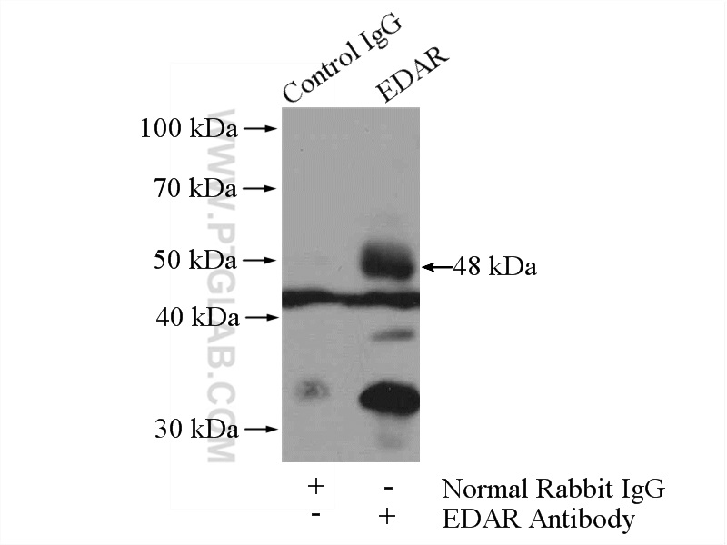 IP experiment of A549 using 18032-1-AP