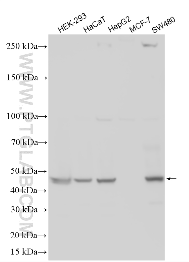 WB analysis using 18032-1-AP WB analysis using 18032-1-AP