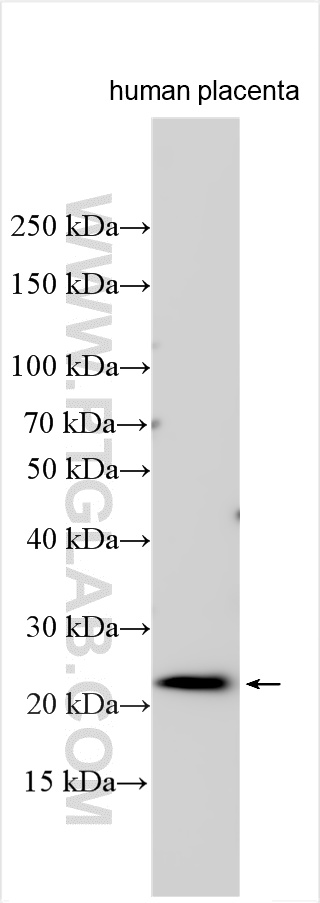 WB analysis using 32485-1-AP (same clone as 32485-1-PBS) WB analysis using 32485-1-AP (same clone as 32485-1-PBS)