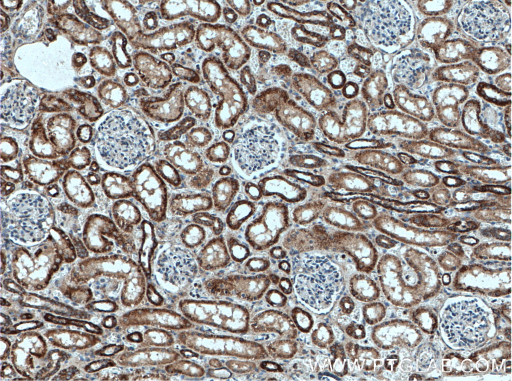 IHC staining of human kidney using 16486-1-AP