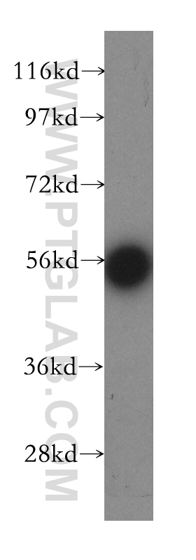 EDC3 Polyclonal antibody