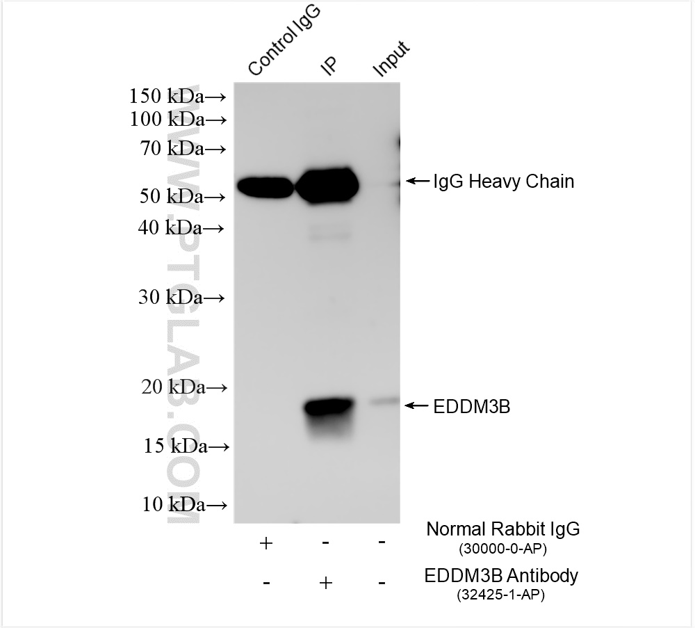 IP experiment of human testis using 32425-1-AP