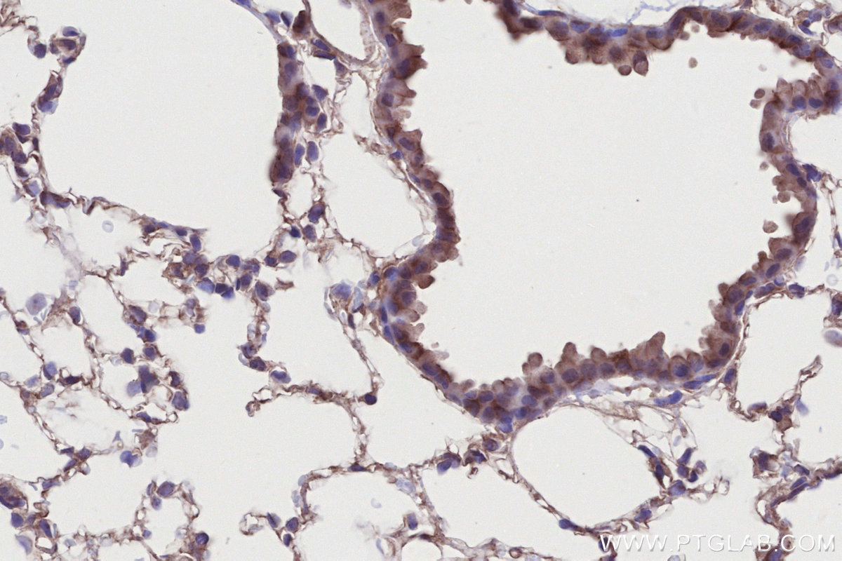 IHC staining of mouse lung using 26226-1-AP IHC staining of mouse lung using 26226-1-AP