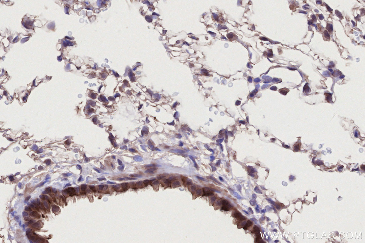 IHC staining of rat lung using 26226-1-AP IHC staining of rat lung using 26226-1-AP