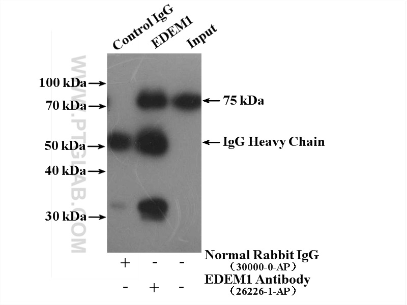 IP experiment of mouse liver using 26226-1-AP