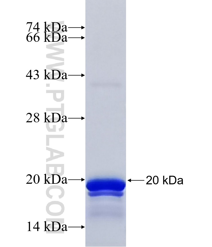 EDEM1 fusion protein Ag41790 SDS-PAGE EDEM1 fusion protein Ag41790 SDS-PAGE