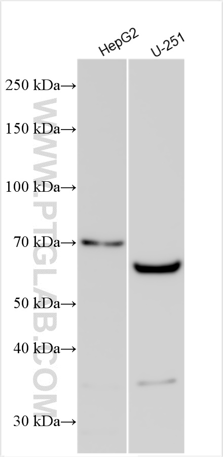 WB analysis using 11241-1-AP