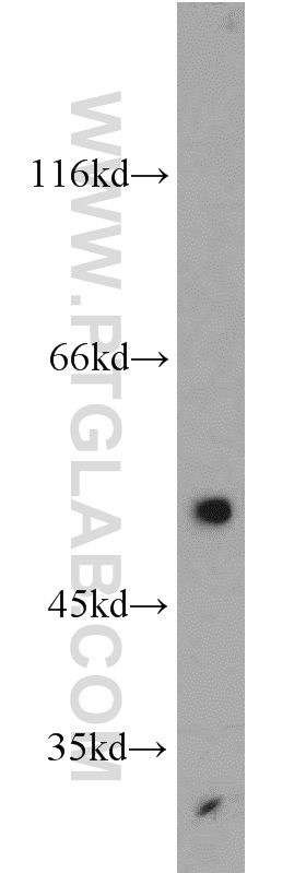 EDNRB Polyclonal antibody