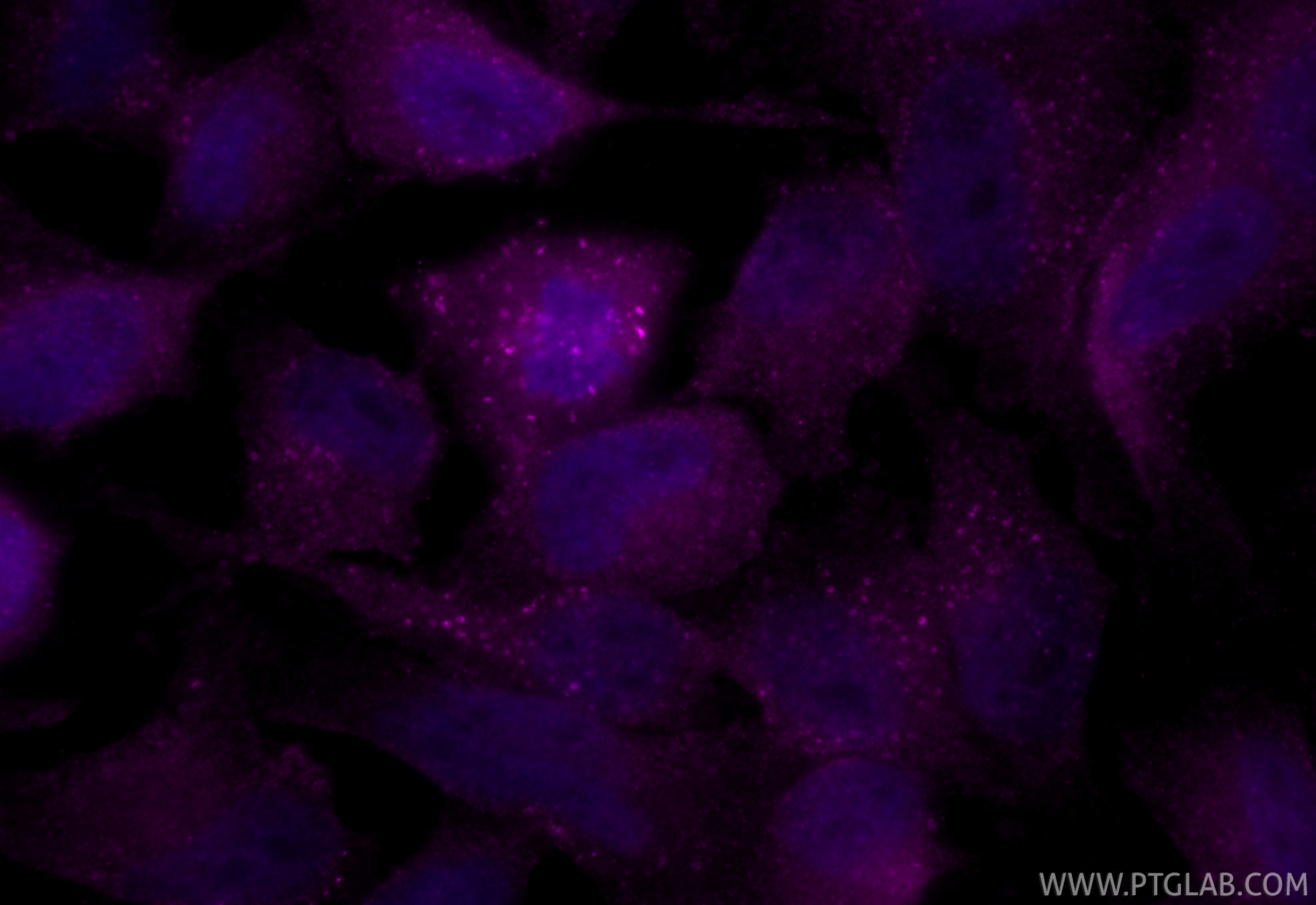 Immunofluorescent analysis of (4% PFA) fixed HeLa cells using CoraLite® Plus 647 EEA1 antibody (CL647-28347) at dilution of 1:200. IF Staining of HeLa using CL647-28347