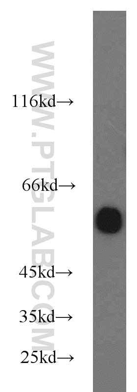 WB analysis of COLO 320 using 16818-1-AP