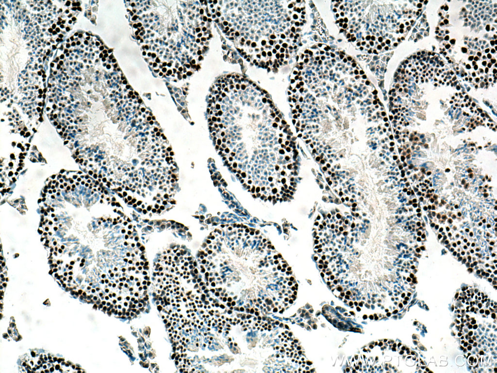 IHC staining of mouse testis using 67756-1-Ig