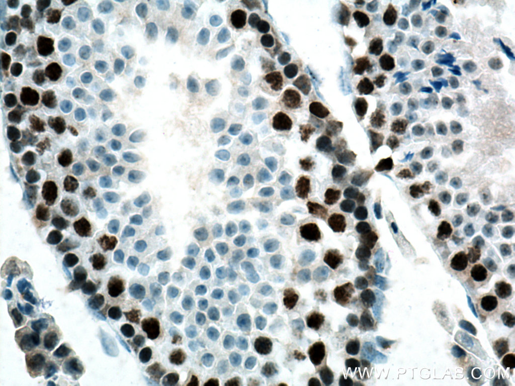 IHC staining of mouse testis using 67756-1-Ig