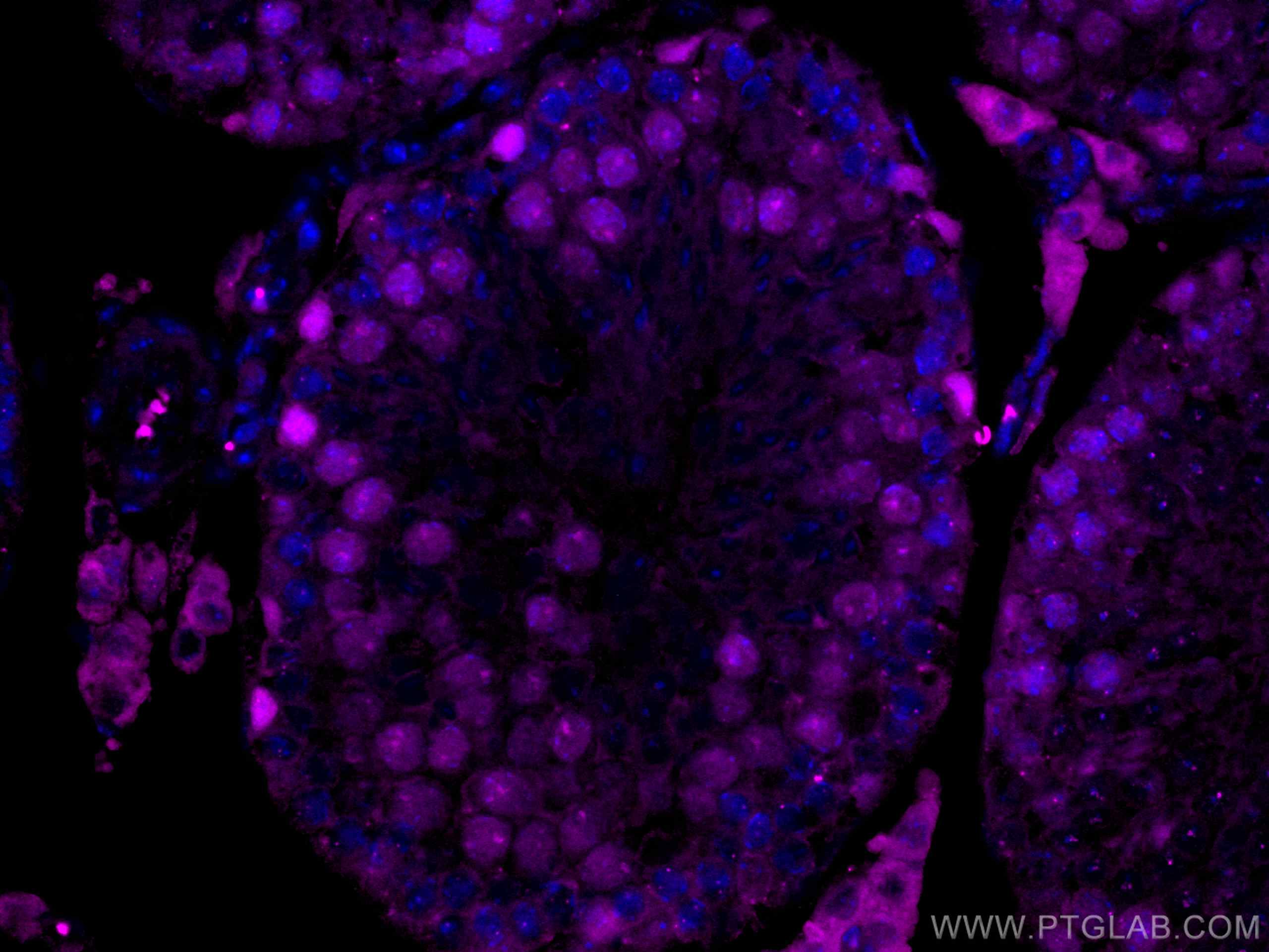 IF Staining of mouse testis using CL647-67756