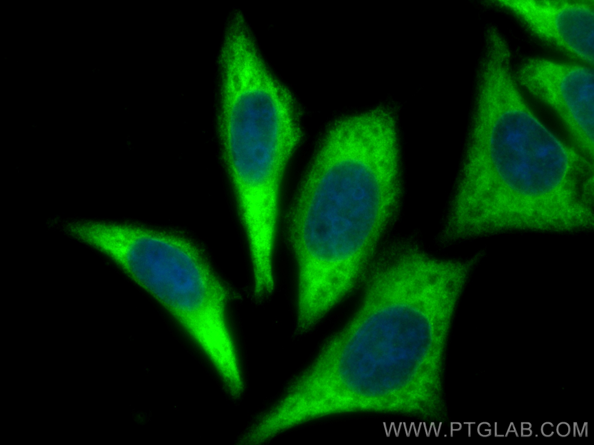 IF Staining of HepG2 using 11402-1-AP