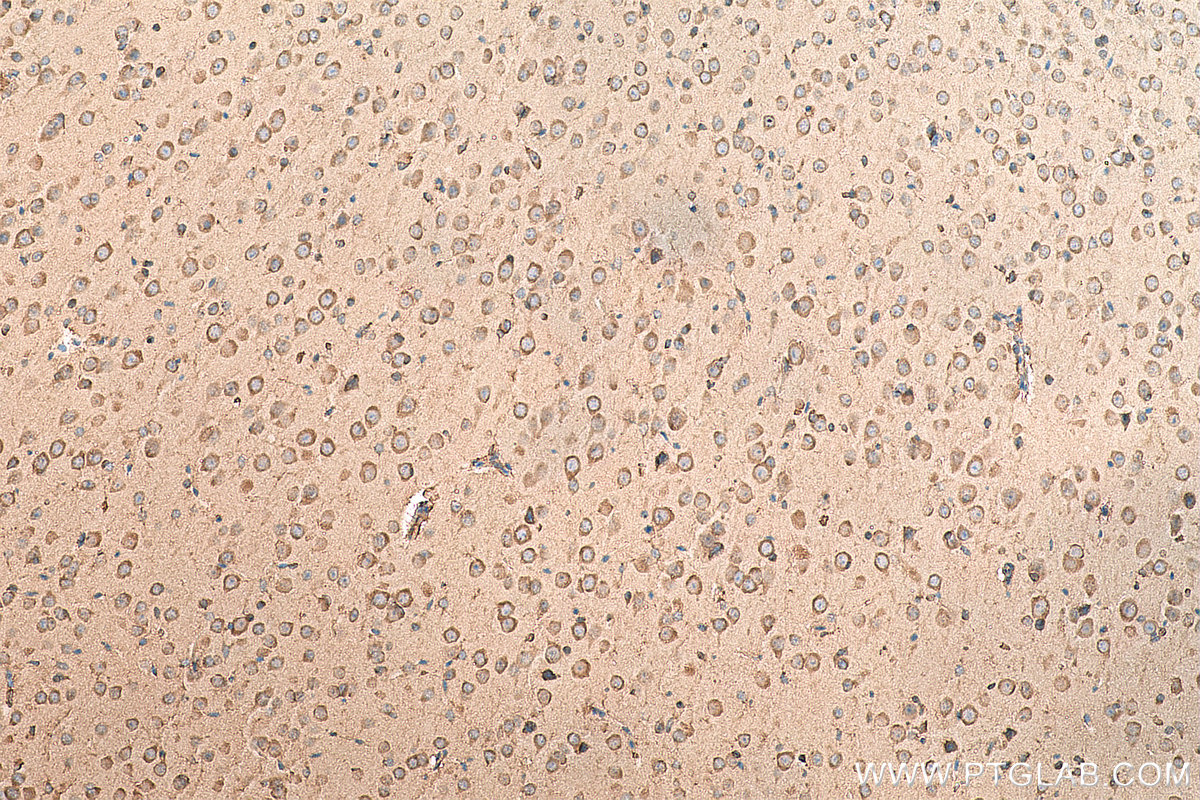 IHC staining of mouse brain using 11402-1-AP