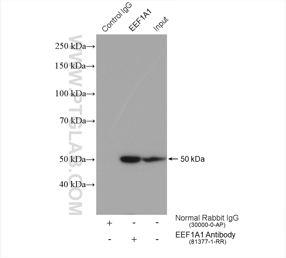 IP experiment of HeLa using 81377-1-RR