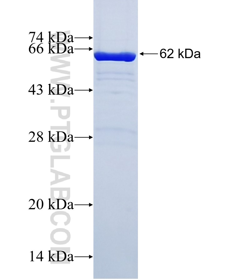 EEF1A1 fusion protein Ag1938 SDS-PAGE