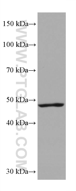 WB analysis of rat brain using 66806-1-Ig