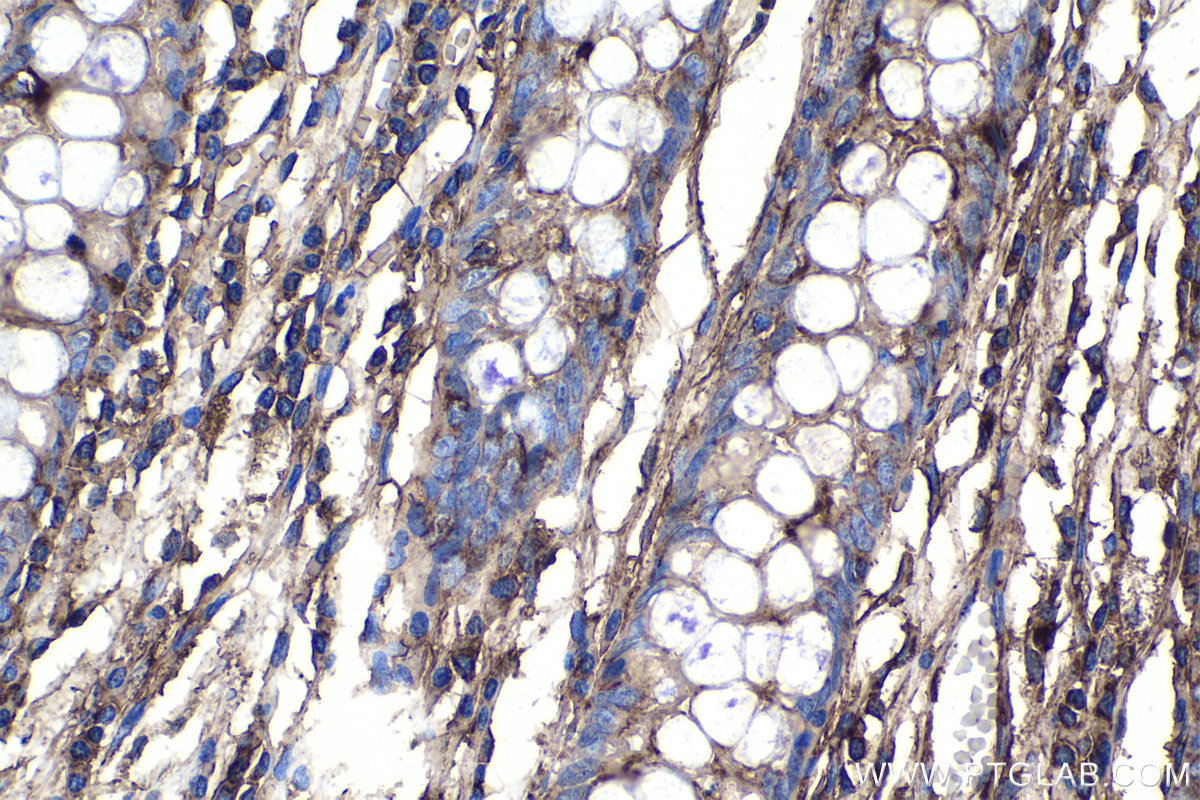 IHC staining of human colon using 10095-2-AP