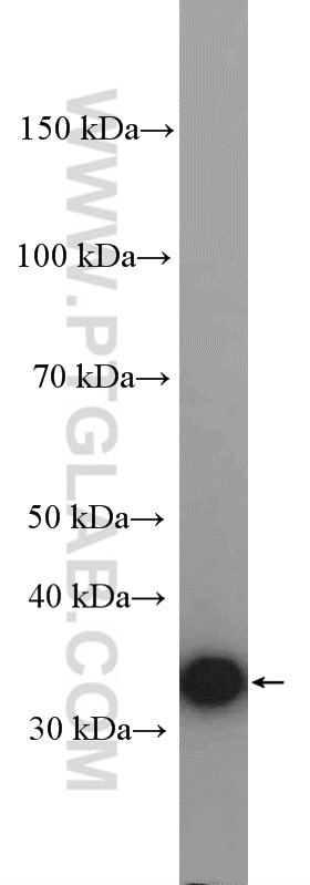 WB analysis of HeLa using 10095-2-AP