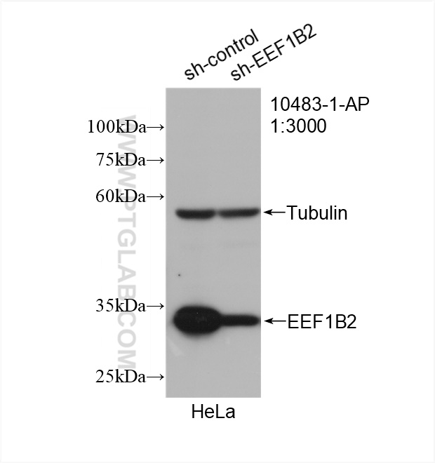 WB analysis of HeLa using 10483-1-AP