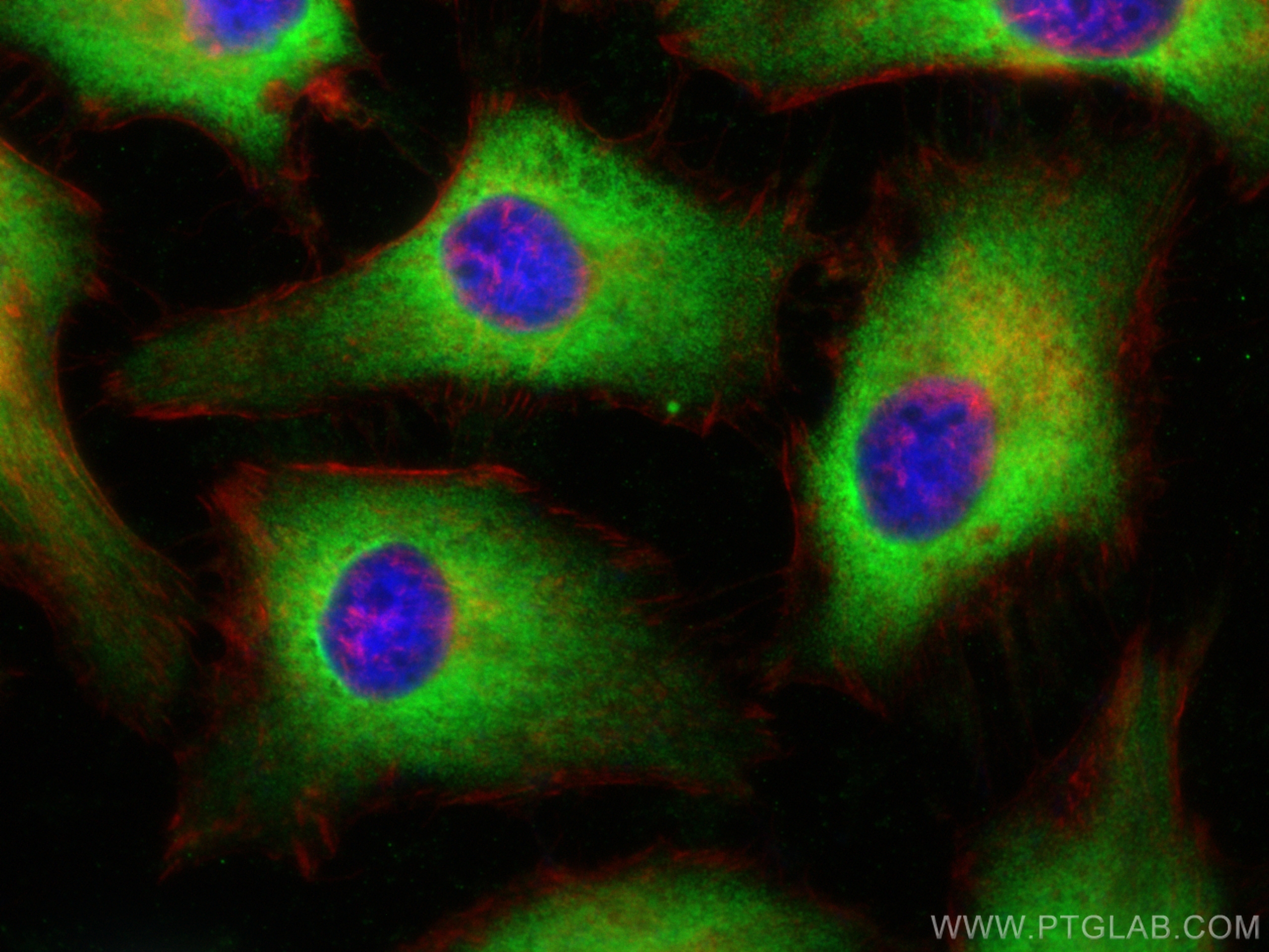 IF Staining of HeLa using 60085-1-Ig (same clone as 60085-1-PBS)