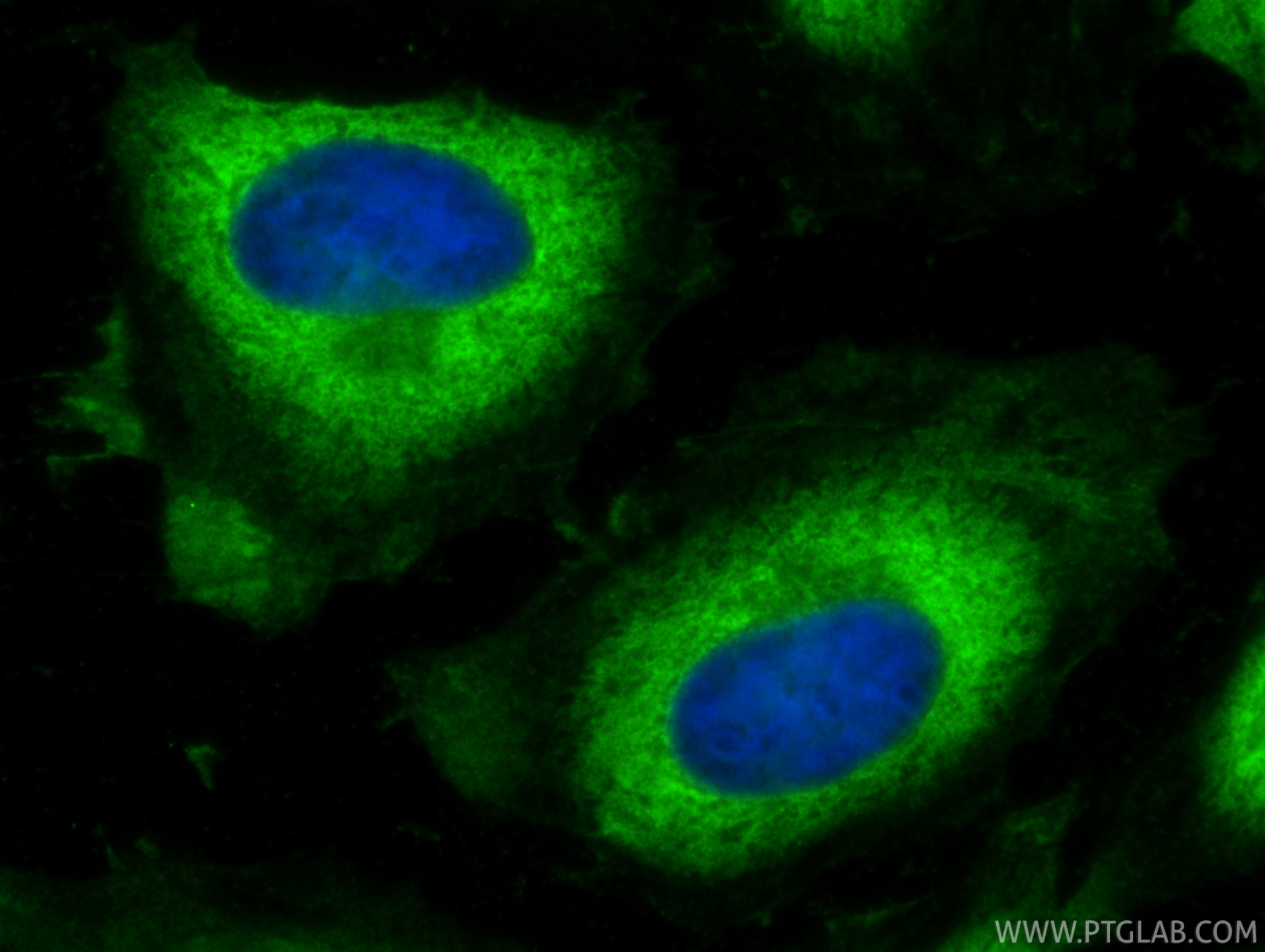 IF Staining of HeLa using 60085-2-Ig