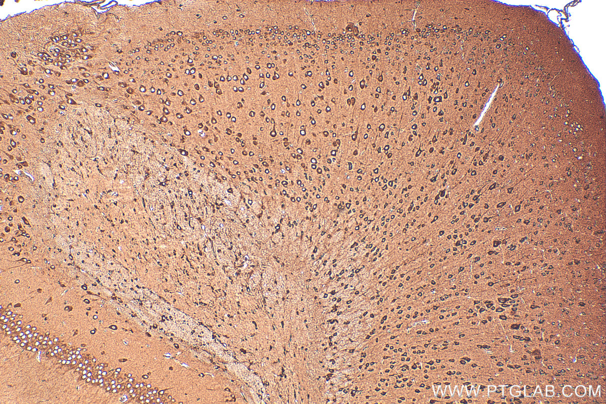 IHC staining of mouse brain using 20107-1-AP
