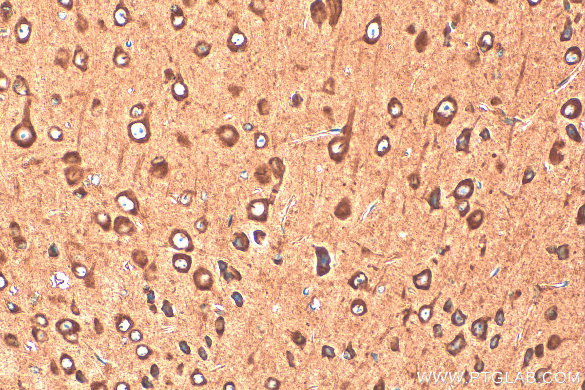 IHC staining of mouse brain using 20107-1-AP