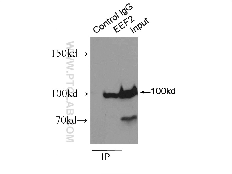 IP experiment of HeLa using 20107-1-AP (same clone as 20107-1-PBS)