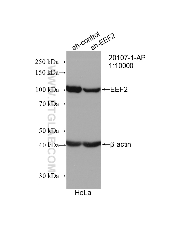 WB analysis of HeLa using 20107-1-AP