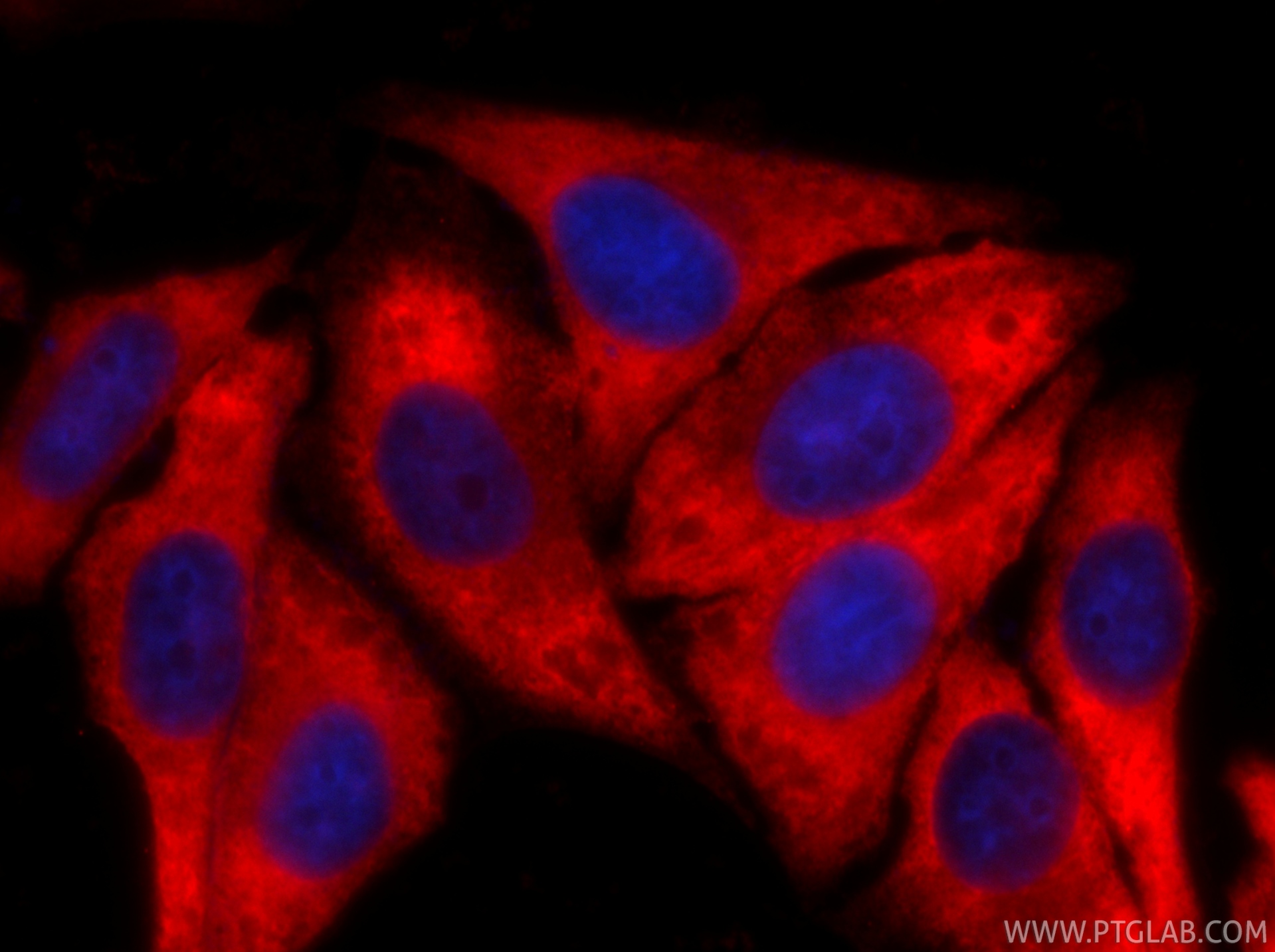 IF Staining of HepG2 using CL594-67550 IF Staining of HepG2 using CL594-67550
