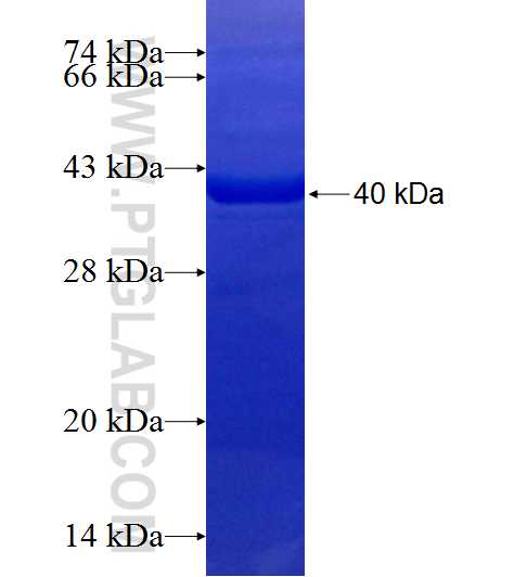 EEPD1 fusion protein Ag19489 SDS-PAGE EEPD1 fusion protein Ag19489 SDS-PAGE