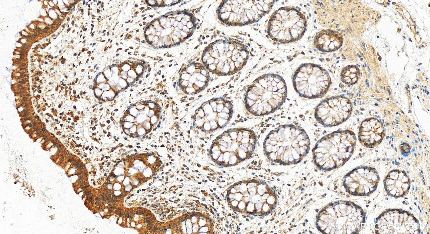 Immunohistochemical analysis of paraffin-embedded human colon tissue slide using 17276-1-AP (EFCAB1 antibody) at dilution of 1:200 (under 20x lens). Heat mediated antigen retrieval with Tris-EDTA buffer (pH 9.0). IHC staining of human colon using 17276-1-AP