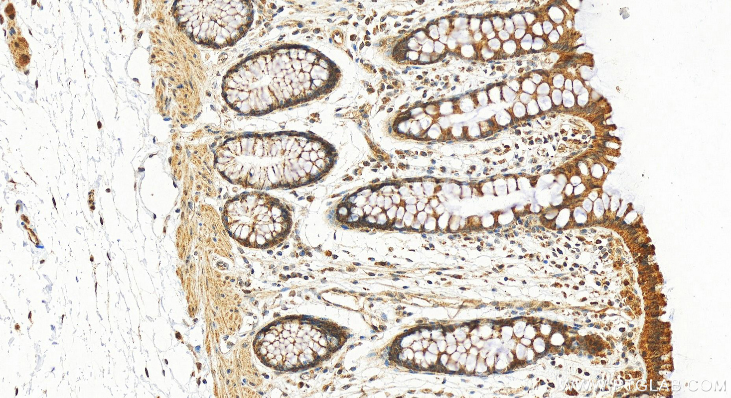 Immunohistochemical analysis of paraffin-embedded human colon tissue slide using 17276-1-AP (EFCAB1 antibody) at dilution of 1:200 (under 20x lens). Heat mediated antigen retrieval with Tris-EDTA buffer (pH 9.0). IHC staining of human colon using 17276-1-AP
