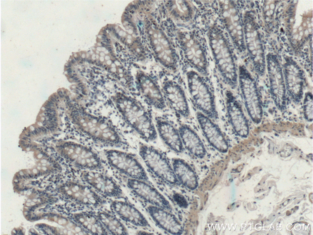 IHC staining of human colon using 17276-1-AP