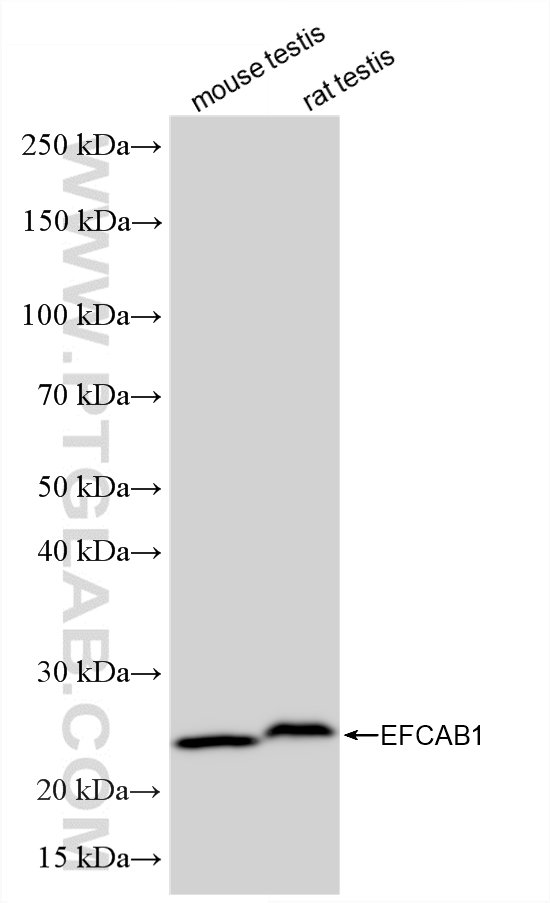WB analysis using 86828-1-RR (same clone as 86828-1-PBS)