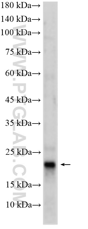 mouse testis tissue were subjected to SDS PAGE followed by western blot with 25156-1-AP (EFCAB2 antibody) at dilution of 1:1000 incubated at room temperature for 1.5 hours. WB analysis of mouse testis using 25156-1-AP