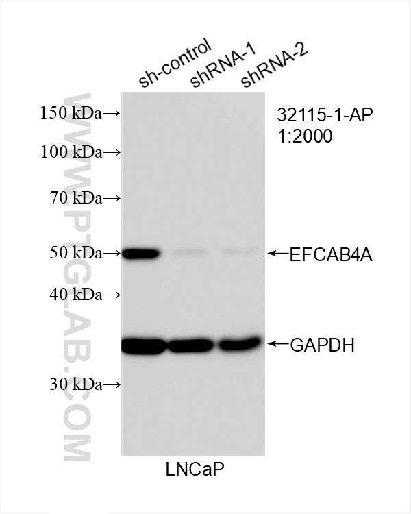 WB analysis of LNCaP using 32115-1-AP