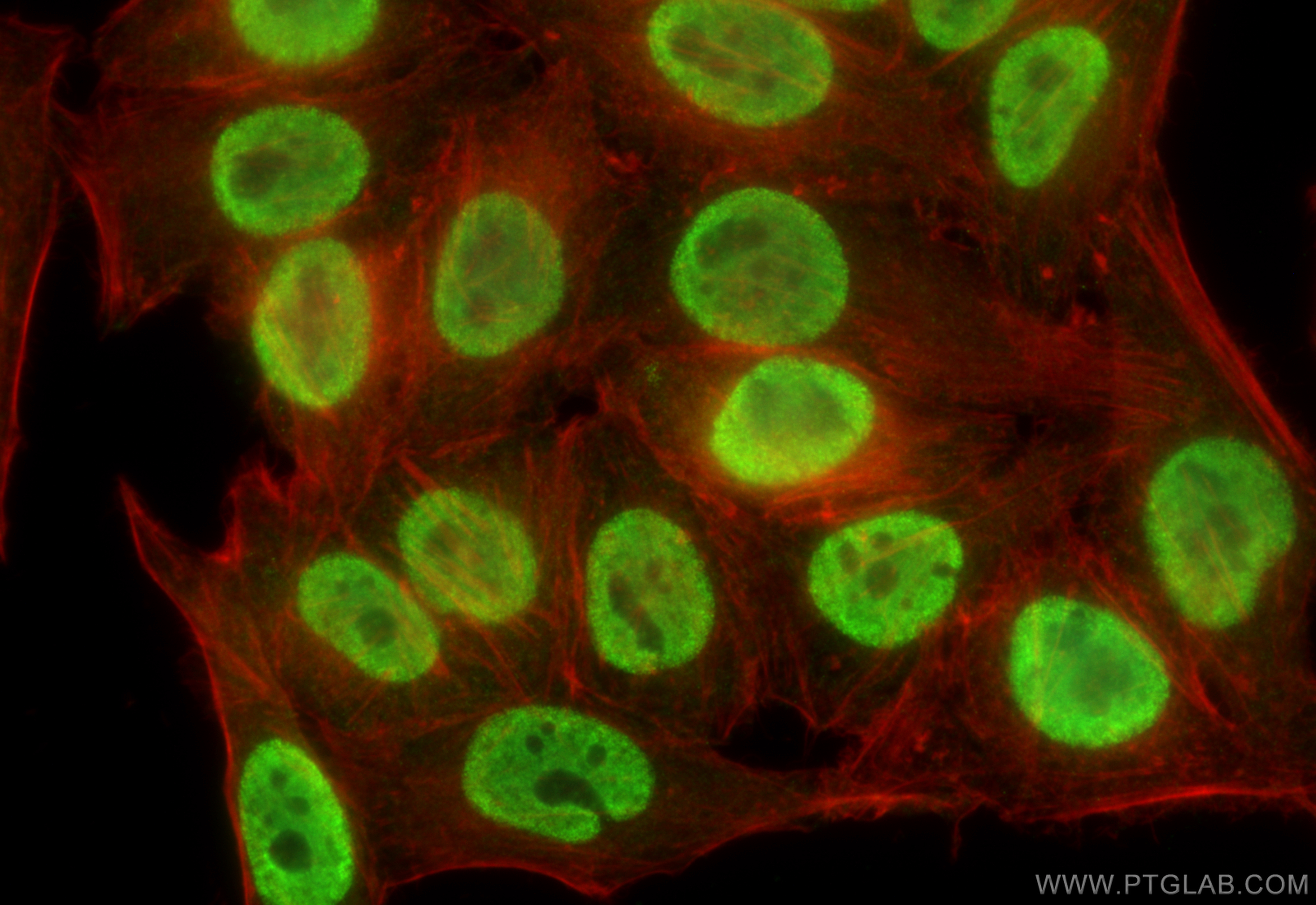 IF Staining of HepG2 using 24296-1-AP