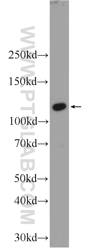 WB analysis of HepG2 using 24296-1-AP