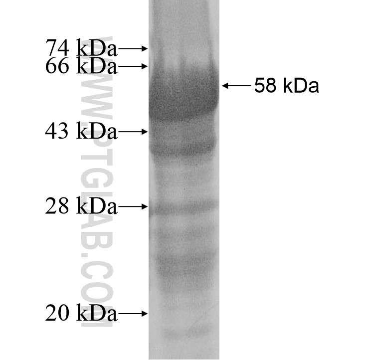 EFHA1 fusion protein Ag14914 SDS-PAGE EFHA1 fusion protein Ag14914 SDS-PAGE
