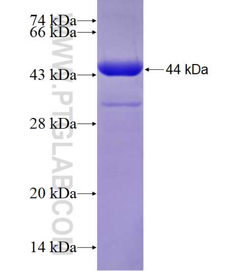 EFHC1 fusion protein Ag28989 SDS-PAGE EFHC1 fusion protein Ag28989 SDS-PAGE