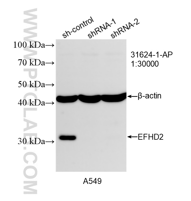 WB analysis of A549 using 31624-1-AP