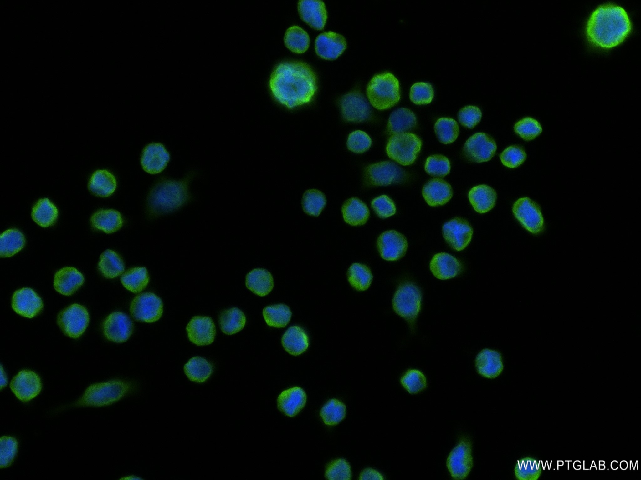 IF Staining of COLO 205 using 82951-1-RR