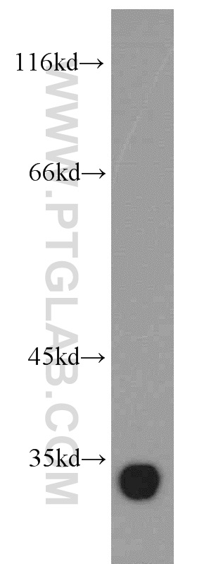 Ephrin A3 Polyclonal antibody